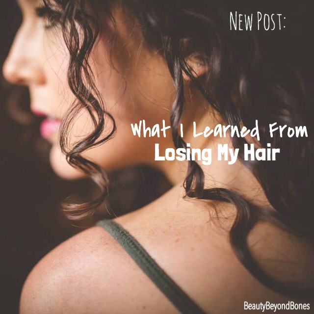 *What I Learned From Losing My&nbsp;Hair